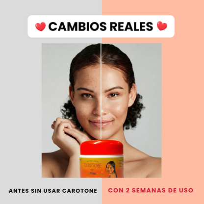 CREMA ACLARANTE CAROTONE 300ML EN PROMO 2X1